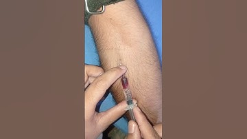 How to give i.v injection state#medico #nursing #youtubeshorts #shorts