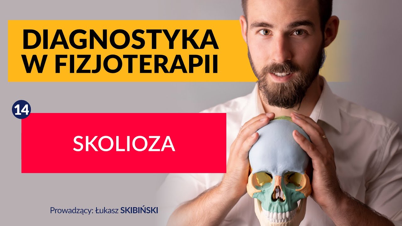 Skolioza. Diagnostyka w fizjoterapii. Odcinek 14