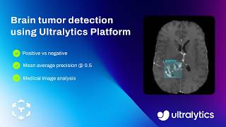 Brain Tumor Detection using Ultralytics Platform with Ultralytics YOLO26 | Object Detection 🚀