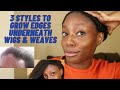 3 Styles to Grow Your Edges Underneath Wigs & Weaves | Traction Alopecia