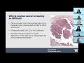OncoMenopause ECHO - Session 3 - 9-21-26