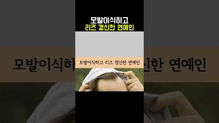 모발이식하고 리즈 갱신한 연예인