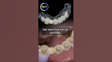 Using a FAST STENT to Reline DENTAL Provisional #dentalshorts