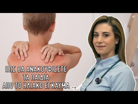 Health Line: Πώς θα ανακουφίσετε τα παιδιά από το ηλιακό έγκαυμα