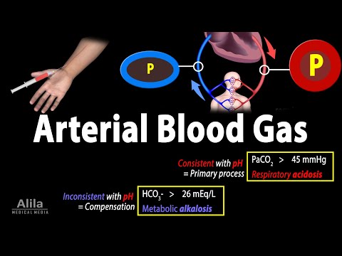 Arterial Blood Gas (ABG) Test, Animation