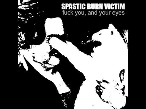 Spastic Burn Victim - Fuck You And Your Eyes CS [2014]