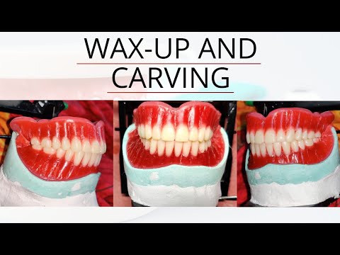 Wax up Carving