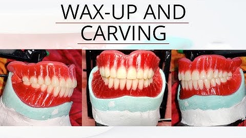 Wax up Carving and feestoning complete denture