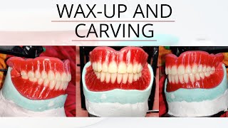 : Wax up Carving and feestoning complete denture
