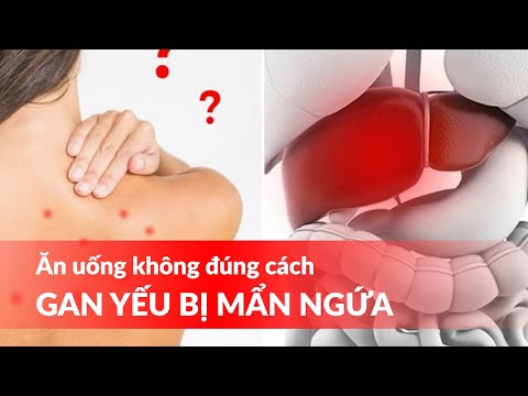 Ăn uống không đúng cách, gan yếu bị mẩn ngứa