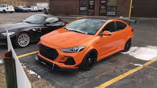 BTR Vlog #2 (BTR Edition Elantra Sport Overview)