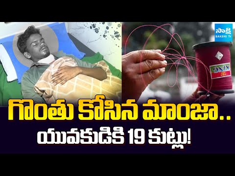 చైనా మాంజాతో జాగ్రత్త..! | Keesara Chinese Manja Accident : Young Man Injured, 19 Stitches | Sakshi - SAKSHITV