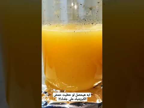 إيه هيحصل لو حطيت حمض الكبريتيك علي جلدك