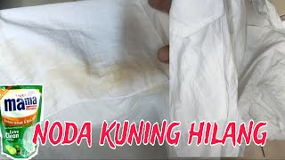 Cara Menghilangkan Noda Kuning Dibaju Putih