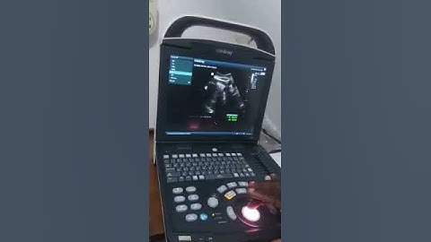 Training of End User on Mindray DP10 Ultrasound Machine by DAFFSER Biomedical Engineer.