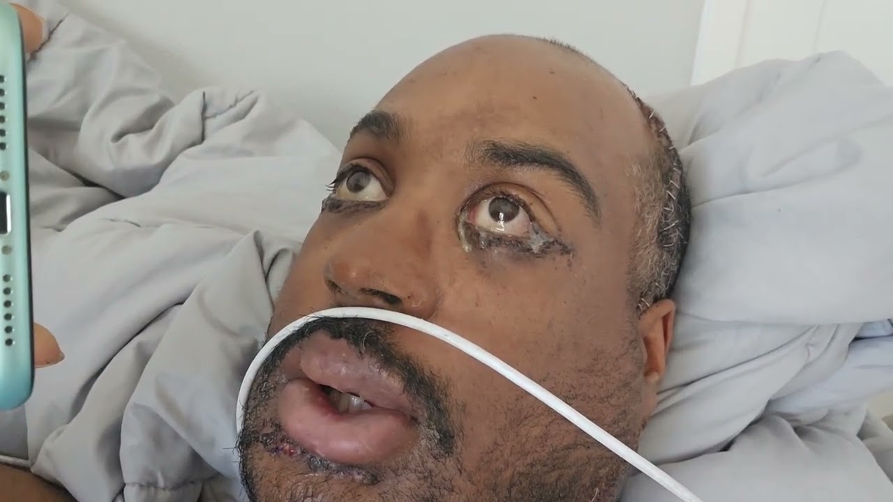 When you get into an accident and your boss calls in the middle of surgery, on YouTube