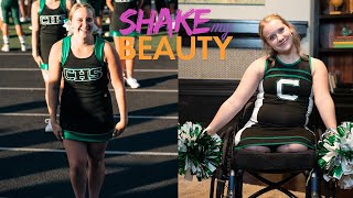 I Lost My Legs At 17  But I'm Still A Cheerleader | SHAKE MY BEAUTY