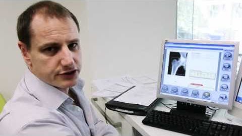 MeasureUp - Bone Density Scan