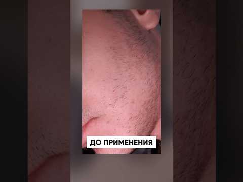 БУСТ ДЛЯ БОРОДЫ: вот так работает ксиноксин 15