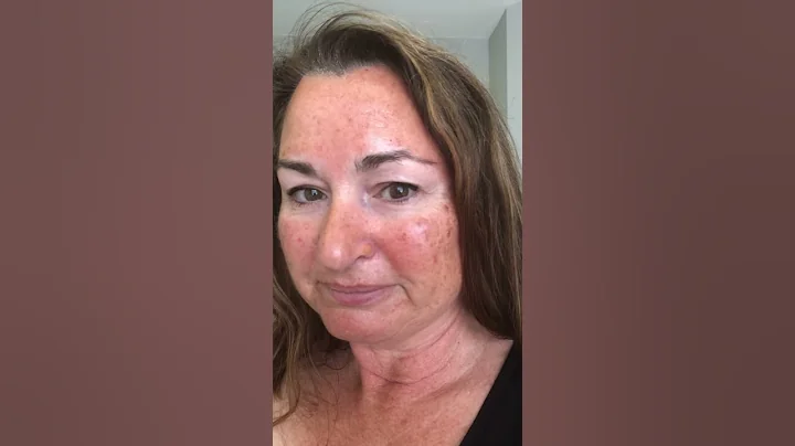 Texas Ruby Peel - Day 2 Before Shower (Day after p...