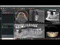 Demo QuickVision 3D software