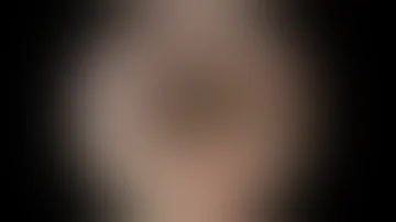 Che cos'è il Papilloma alla vescica?