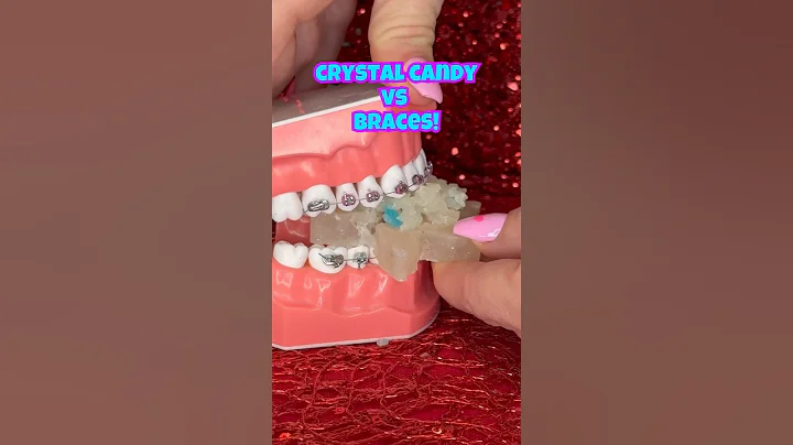 Are crunchy CRYSTAL CANDIES safe for BRACES? (ASMR eating) #shorts #asmr #braces