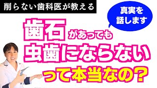 【歯科　歯石取り】歯石があっても虫歯や歯周病にはならない？って本当？歯のクリーニングとメンテナンスの話と絡めて真実をお話しします