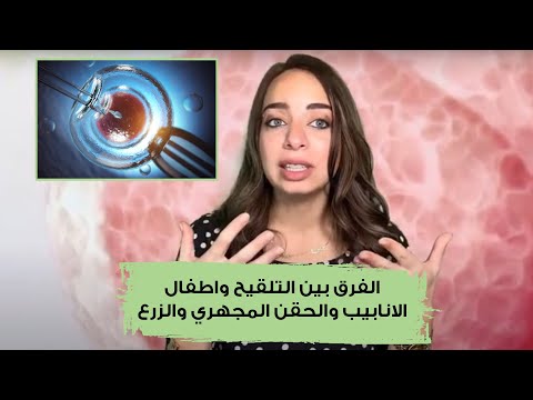 الفرق بين التلقيح واطفال الانابيب والحقن المجهري والزرع