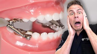 How This Dental Device Can Go Very Wrong!