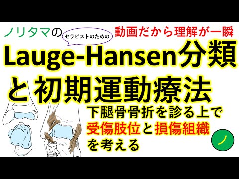 ラーグ・ハンセン分類(足関節骨折の分類)と初期運動療法