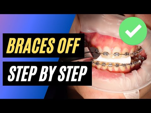 BRACES OFF - Step by step orthodontic removal