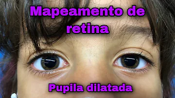 O que é mapeamento de retina em bebê?