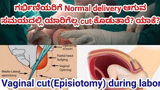 Episiotomy(Vaginal cut) During Normal delivery|Normal delivery tips|Aayushi RS screenshot 2