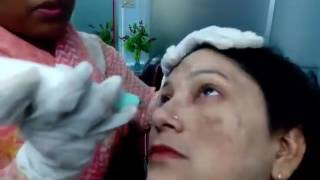 মেয়েরা না দেখলে চরম মিস করবেন, একজন ক্লাইন্ট তার মায়ের মেছতা ও কাল দাগ নিয়ে কি বলছে ?