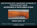 Как удаляются шрамы от порезов? - Лечение шрамов от порезов