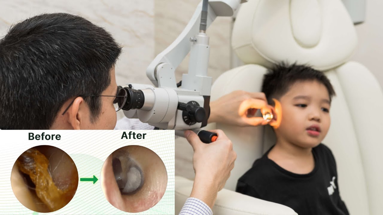 Remove Earwax Ear Wax removal How to remove earwax YouTube