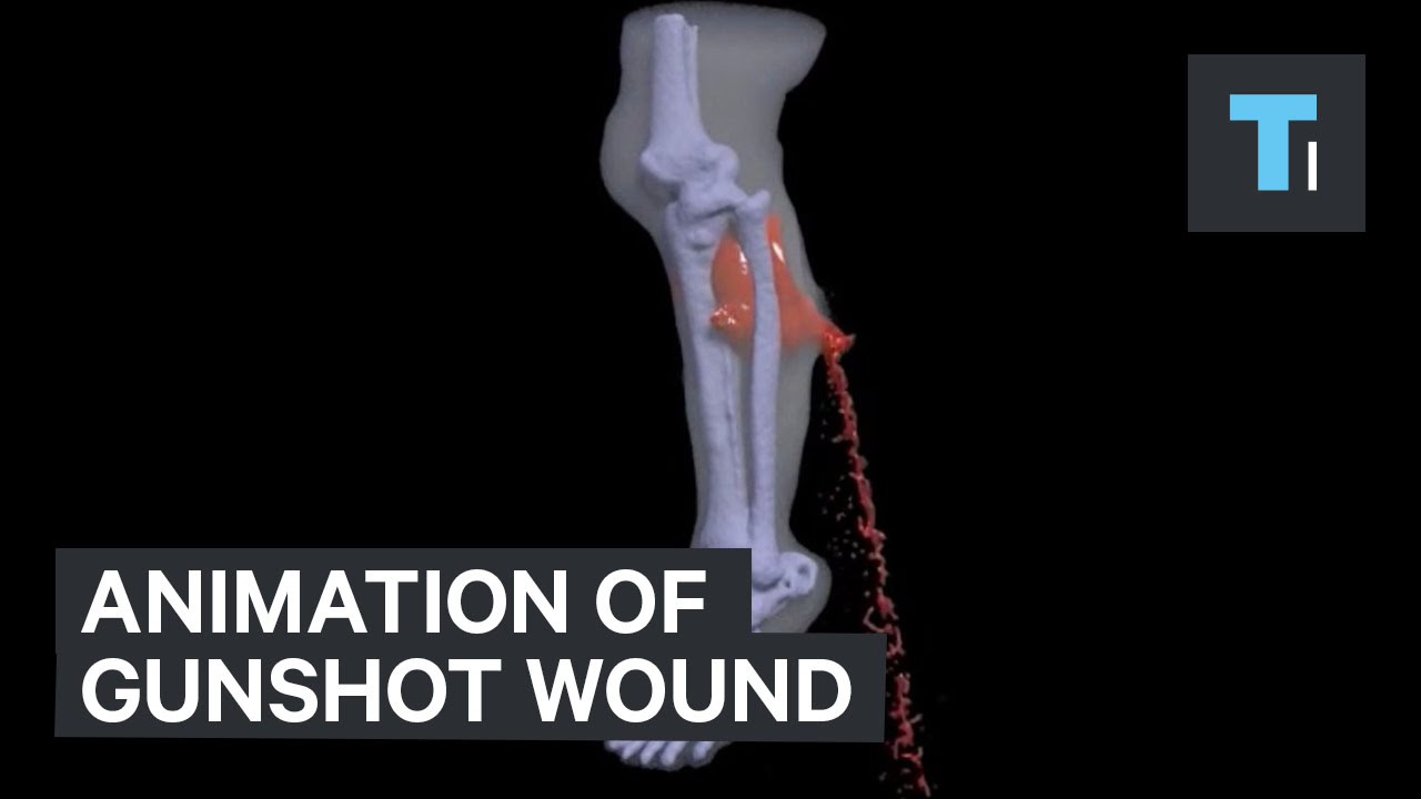 Animation of gunshot wound - YouTube