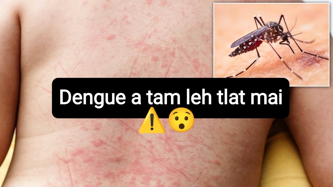 Dengue thu thar, kan hriat tur 