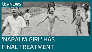 Vietnam 'Napalm Girl' receives final skin treatment 50 years after war-defining photo | ITV News