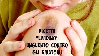 Ricetta LIVIDINO - Unguento contro gli ematomi(In questo video tutorial vediamo la realizzazione di un unguento contro i lividi (ematomi) a base di arnica. ✿✿✿✿✿✿✿✿✿✿✿✿✿✿✿✿✿✿✿✿ Mi trovate anche..., 2016-11-28T09:08:35.000Z)