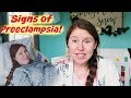 HOW I KNEW I HAD PREECLAMPSIA,  symptoms and more | Our NICU Journey