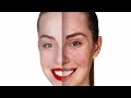 How to remove acne &amp; pimples from face in photoshop | Remove Blemishes &amp; Scars