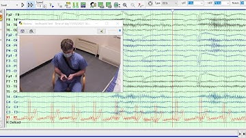 Electroencephalogram
