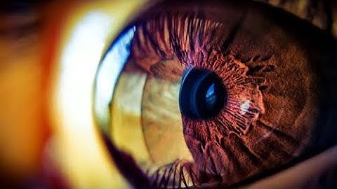 Panoptic Ophthalmoscope | How To Use | Ophthalmology | Diagnosis Video | Ep. No.3