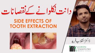 Side Effects Of Tooth Extraction Dr. Inqalab Fareed Urdu Hindi