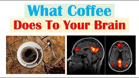 Coffee and the Brain (Default Mode Network, Visual Cortex, Right Executive Control Network)