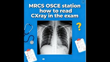 MRCS OSCE Station Chest X-ray: Examiner-Approved Guide to Reading CXR in the Exam.