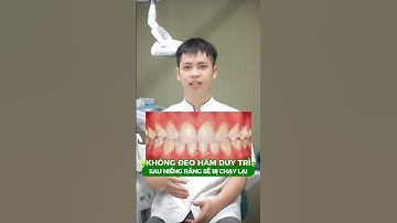 Hành trình niềng răng chưa kết thúc nếu còn thiếu hàm duy trì #nhakhoagreenlife #niengrang