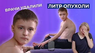 видео: CLOVES-СИНДРОМ | История Ильи Бусарова картинка: CLOVES-СИНДРОМ | История Ильи Бусарова